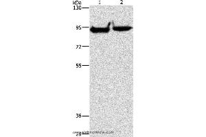 Western blot analysis of Mouse heart and brain tissue, using MARK1 Polyclonal Antibody at dilution of 1:500 (MARK1 抗体)