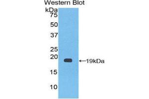Western Blotting (WB) image for anti-Coagulation Factor VIII (F8) (AA 1887-2044) antibody (ABIN1858766) (Factor VIII 抗体  (AA 1887-2044))
