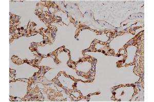 Immunohistochemistry (IHC) image for anti-zeta-Chain (TCR) Associated Protein Kinase 70kDa (ZAP70) (pTyr319) antibody (ABIN6255884)