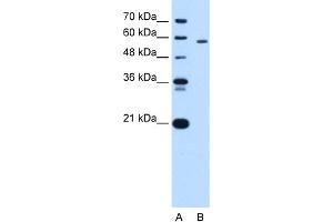 PKLR antibody - N-terminal region  validated by WB using HepG2 cell lysate at 1. (PKLR 抗体  (N-Term))