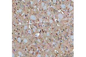 IHC analysis of ABI2 using anti-ABI2 antibody (ABIN7600125). (ABI2 抗体  (AA 151-400))