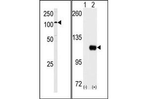 Image no. 2 for anti-Hexokinase 1 (HK1) (C-Term) antibody (ABIN360645) (Hexokinase 1 抗体  (C-Term))