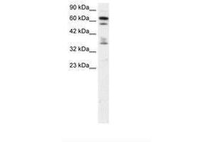 ZNF512 Antikörper  (AA 205-254)