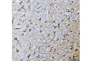 IHC analysis of Septin 2/SEPTIN2 using anti-Septin 2/SEPTIN2 antibody (ABIN7599275). (Septin 2 抗体  (AA 1-326))