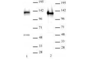 SMARCA1 / SNF2L1 antibody (rAb) tested by Western blot. (Recombinant SMARCA1 抗体)