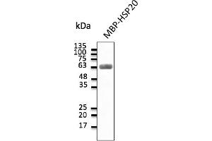 Western Blotting (WB) image for anti-Heat Shock Protein, alpha-Crystallin-Related, B6 (HSPB6) antibody (ABIN7273045) (HSPB6 抗体)
