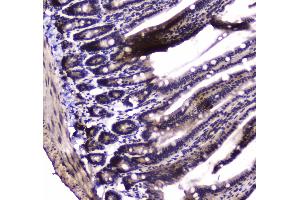IHC analysis of PARN using anti-PARN antibody . (PARN 抗体  (AA 1-301))