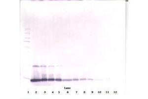 Image no. 1 for anti-Interleukin 4 (IL4) antibody (ABIN465482) (IL-4 抗体)