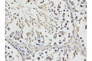 Immunohistochemistry (IHC) image for anti-Ribosomal Protein S3 (RPS3) antibody (ABIN1874658) (RPS3 抗体)