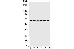 Western blot testing of SCYL antbody on Lane 1: U87;  2: HeLa;  3: 293T;  4: MCF-7;  5: COLO320;  6: HE1080 cell lysate (SCLY 抗体  (C-Term))
