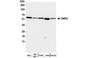 Western Blotting (WB) image for anti-Glucose-6-Phosphate Dehydrogenase (G6PD) (AA 50-100) antibody (ABIN7449226)