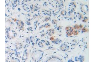 DAB staining on IHC-P; Samples: Human Stomach Tissue (BNP 抗体  (AA 27-134))