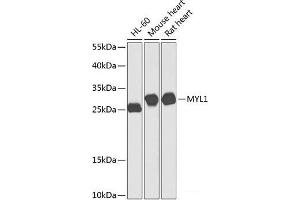 Western blot analysis of extracts of various cell lines using MYL1 Polyclonal Antibody at dilution of 1:1000. (MYL1 抗体)