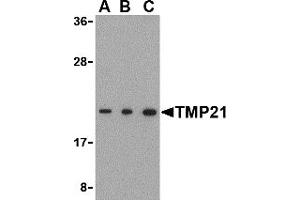 Western Blotting (WB) image for anti-Transmembrane Emp24-Like Trafficking Protein 10 (TMED10) (C-Term) antibody (ABIN1030758) (TMED10 抗体  (C-Term))