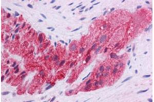 Human Colon, Myenteric Plexus: Formalin-Fixed, Paraffin-Embedded (FFPE) (KLF2 抗体  (AA 216-265))