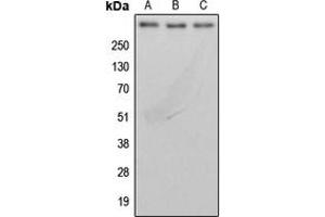 Western blot analysis of BRCA2 expression in MDAMB231 (A), MCF7 (B), rat lung (C) whole cell lysates. (BRCA2 抗体  (N-Term))