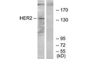 Western blot analysis of extracts from 293 cells, using HER2 Antibody. (ErbB2/Her2 抗体  (AA 641-690))
