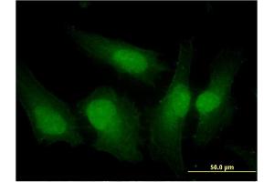 Immunofluorescence of monoclonal antibody to IRF3 on HeLa cell. (IRF3 抗体  (AA 1-452))