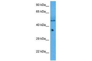 Host:  Rabbit  Target Name:  KLF5  Sample Tissue:  Mouse Pancreas  Antibody Dilution:  1ug/ml (KLF2 抗体  (Middle Region))