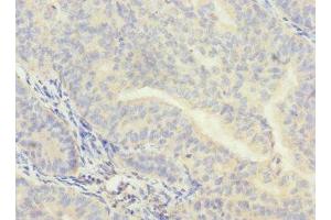 Immunohistochemistry (IHC) image for anti-Cleavage and Polyadenylation Specific Factor 4, 30kDa (CPSF4) (AA 1-244) antibody (ABIN7147920)