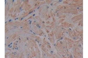 DAB staining on IHC-P; Samples: Human Prostate Tissue (MMP2 抗体  (AA 110-660))