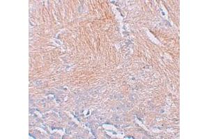 Immunohistochemistry (IHC) image for anti-CXXC Finger Protein 5 (CXXC5) (N-Term) antibody (ABIN1031339)