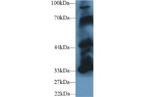 Detection of PTPN5 in Mouse Cerebrum lysate using Polyclonal Antibody to Protein Tyrosine Phosphatase, Non Receptor Type 5 (PTPN5) (PTPN5 抗体  (AA 270-533))