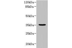 Western blot All lanes: NUBPL antibody at 1 μg/mL + A431 whole cell lysate Secondary Goat polyclonal to rabbit IgG at 1/10000 dilution Predicted band size: 35, 19 kDa Observed band size: 35 kDa (NUBPL 抗体  (AA 39-319))