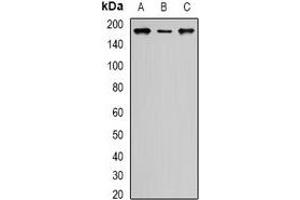 Western blot analysis of SIN3A expression in Hela (A), MCF7 (B), COS7 (C) whole cell lysates.