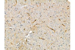 ABIN7093250 and ABIN7097267 at 1/100 staining Rat brain tissue by IHC-P. (NCF1 抗体  (pSer345))