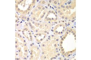 Immunohistochemistry of paraffin-embedded human kidney using SPIN2B antibody at dilution of 1:100 (x400 lens). (Spindlin 2B 抗体)