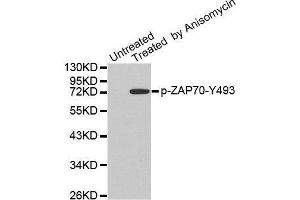 Western blot analysis of extracts from JK cells, using Phospho-ZAP70-Y493 antibody. (ZAP70 抗体  (pTyr493))