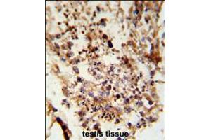 Formalin-fixed and paraffin-embedded human testis tissue reacted with ACR Antibody , which was peroxidase-conjugated to the secondary antibody, followed by DAB staining. (Achaete-scute complex protein T5 (AC) (AA 387-416), (C-Term) 抗体)