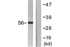 Western blot analysis of extracts from HeLa cells, treated with TNF-a 20ng/ml 2', using S6 Ribosomal Protein (Ab-240) Antibody. (RPS6 抗体  (AA 191-240))