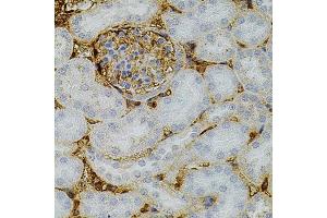Immunohistochemistry of paraffin-embedded mouse kidney using NTF3 antibody (ABIN3017531, ABIN3017532, ABIN3017533 and ABIN6220139) at dilution of 1:100 (40x lens). (Neurotrophin 3 抗体)