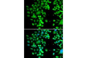 Immunofluorescence analysis of MCF-7 cells using PHYHD1 antibody. (PHYHD1 抗体)