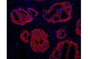 Immunofluorescence (IF) image for anti-ATP-Binding Cassette, Sub-Family B (MDR/TAP), Member 9 (ABCB9) (AA 475-525) antibody (ABIN7448927)