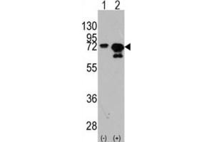 Western Blotting (WB) image for anti-Heat Shock 70kDa Protein 1A (HSPA1A) antibody (ABIN3003300) (HSP70 1A 抗体)