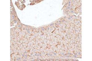 Immunohistochemistry of paraffin-embedded Mouse testis using KIAA1524 Polyclonal Antibody at dilution of 1:100 (40x lens). (KIAA1524 抗体)
