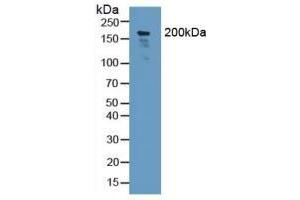 Detection of NID2 in Human Lung Tissue using Polyclonal Antibody to Nidogen 2 (NID2) (NID2 抗体  (AA 31-289))