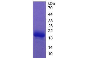 Image no. 1 for Coagulation Factor II (thrombin) (F2) (AA 201-323) (Active) protein (His tag) (ABIN6239861)