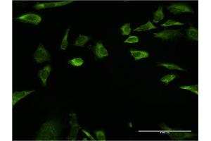 Immunofluorescence (IF) image for anti-Ribosomal Protein, Large, p1 (RPLP1) (AA 1-114) antibody (ABIN948419)