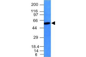 Western Blot Analysis Raji cell lysate Vimentin Mouse Monoclonal Antibody (VM452). (Vimentin 抗体)