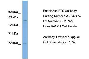 WB Suggested Anti-FTO  Antibody Titration: 0. (FTO 抗体  (Middle Region))
