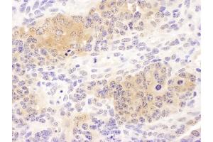 Immunohistochemistry (IHC) image for anti-Chaperonin Containing TCP1, Subunit 8 (Theta) (CCT8) (AA 448-498) antibody (ABIN7453620) (CCT8 抗体  (AA 448-498))