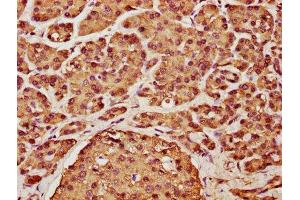 Immunohistochemistry (IHC) image for anti-Cyclin D2 (CCND2) (AA 1-289) antibody (ABIN7153389)