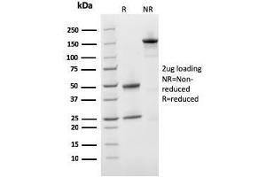 SDS-PAGE Analysis Purified Prohibitin Mouse Monoclonal Antibody (PHB/3231).