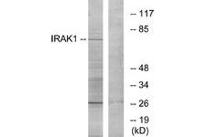 Western blot analysis of extracts from NIH-3T3 cells, using IRAK1 (Ab-209) Antibody. (IRAK1 抗体  (AA 175-224))