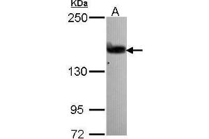 WB Image Sample (30 ug of whole cell lysate) A: A431 , 5% SDS PAGE antibody diluted at 1:1000 (ARHGEF5 抗体  (N-Term))