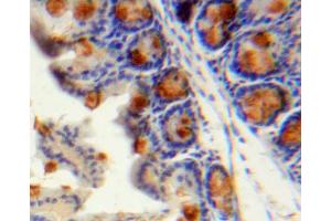 IHC-P analysis of stomach tissue, with DAB staining. (CCL13 抗体  (AA 24-98))